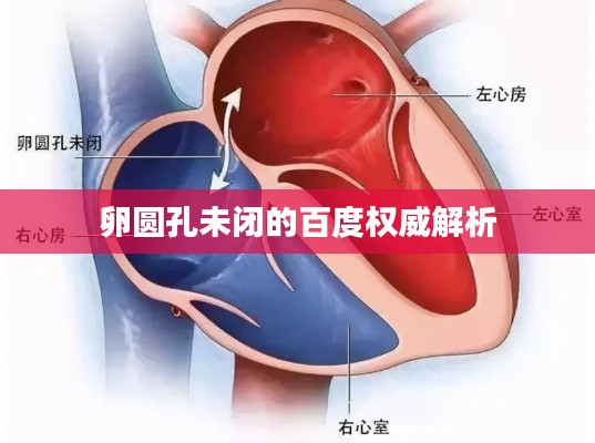 卵圆孔未闭的百度权威解析