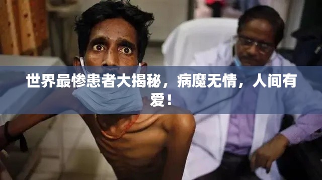 世界最惨患者大揭秘,病魔无情,人间有爱!