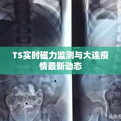 TS实时磁力监测与大连疫情最新动态