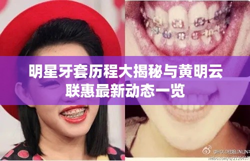 明星牙套历程大揭秘与黄明云联惠最新动态一览