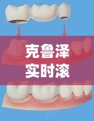 克鲁泽实时滚动数据引领补牙洞市场革新潮流，价格透明与技术革新的并行发展