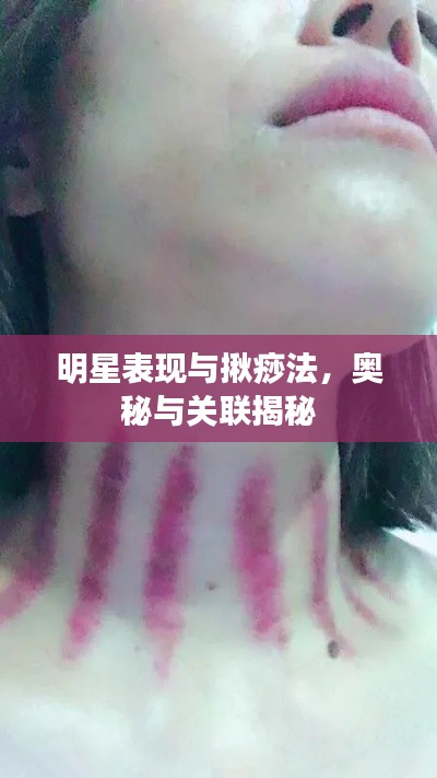 明星表现与揪痧法，奥秘与关联揭秘