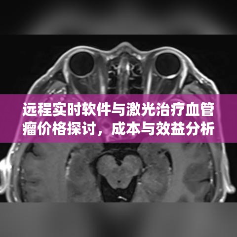 远程实时软件与激光治疗血管瘤价格探讨,成本与效益分析