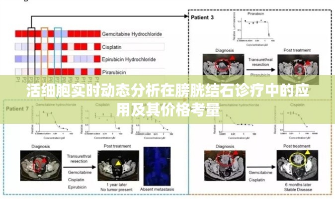 活细胞实时动态分析在膀胱结石诊疗中的应用及其价格考量